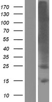 TMEM178 Protein - Western validation with an anti-DDK antibody * L: Control HEK293 lysate R: Over-expression lysate