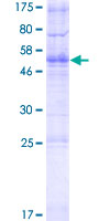 TMEM178 Protein - 12.5% SDS-PAGE of human TMEM178 stained with Coomassie Blue