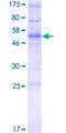TMEM178 Protein - 12.5% SDS-PAGE of human TMEM178 stained with Coomassie Blue