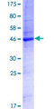 TMEM179 Protein - 12.5% SDS-PAGE of human TMEM179 stained with Coomassie Blue