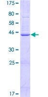 TMEM179B Protein - 12.5% SDS-PAGE of human TMEM179B stained with Coomassie Blue