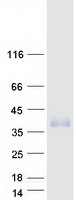 TMEM182 Protein - Purified recombinant protein TMEM182 was analyzed by SDS-PAGE gel and Coomassie Blue Staining
