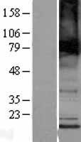 TMEM184B Protein - Western validation with an anti-DDK antibody * L: Control HEK293 lysate R: Over-expression lysate