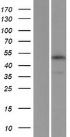TMEM184C Protein - Western validation with an anti-DDK antibody * L: Control HEK293 lysate R: Over-expression lysate
