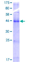 TMEM184C Protein - 12.5% SDS-PAGE of human TMEM34 stained with Coomassie Blue