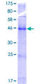 TMEM184C Protein - 12.5% SDS-PAGE of human TMEM34 stained with Coomassie Blue