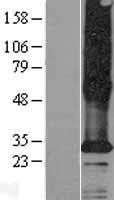 TMEM185A / FAM11A Protein - Western validation with an anti-DDK antibody * L: Control HEK293 lysate R: Over-expression lysate