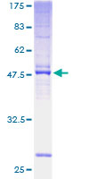 TMEM187 Protein - 12.5% SDS-PAGE of human CXorf12 stained with Coomassie Blue