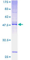TMEM187 Protein - 12.5% SDS-PAGE of human CXorf12 stained with Coomassie Blue