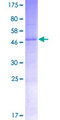 TMEM189 Protein - 12.5% SDS-PAGE of human TMEM189 stained with Coomassie Blue