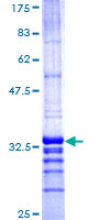 TMEM189-UBE2V1 Protein - 12.5% SDS-PAGE Stained with Coomassie Blue
