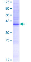 TMEM191C Protein - 12.5% SDS-PAGE Stained with Coomassie Blue