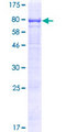 TMEM200A Protein - 12.5% SDS-PAGE of human TMEM200A stained with Coomassie Blue
