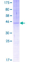 TMEM205 Protein - 12.5% SDS-PAGE of human UNQ501 stained with Coomassie Blue