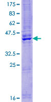 TMEM207 Protein - 12.5% SDS-PAGE of human UNQ846 stained with Coomassie Blue