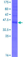 TMEM208 Protein - 12.5% SDS-PAGE of human HSPC171 stained with Coomassie Blue