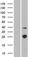 TMEM215 Protein - Western validation with an anti-DDK antibody * L: Control HEK293 lysate R: Over-expression lysate