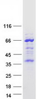 TMEM215 Protein - Purified recombinant protein TMEM215 was analyzed by SDS-PAGE gel and Coomassie Blue Staining