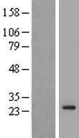 TMEM222 Protein - Western validation with an anti-DDK antibody * L: Control HEK293 lysate R: Over-expression lysate