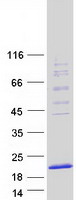 TMEM230 Protein - Purified recombinant protein TMEM230 was analyzed by SDS-PAGE gel and Coomassie Blue Staining