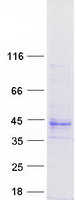 TMEM231 Protein - Purified recombinant protein TMEM231 was analyzed by SDS-PAGE gel and Coomassie Blue Staining