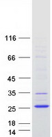 TMEM238 Protein - Purified recombinant protein TMEM238 was analyzed by SDS-PAGE gel and Coomassie Blue Staining