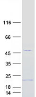 TMEM242 / C6orf35 Protein - Purified recombinant protein TMEM242 was analyzed by SDS-PAGE gel and Coomassie Blue Staining