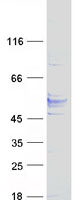 TMEM25 Protein - Purified recombinant protein TMEM25 was analyzed by SDS-PAGE gel and Coomassie Blue Staining