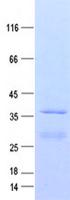 TMEM256 / C17orf61 Protein