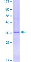 TMEM258 / C11orf10 Protein - 12.5% SDS-PAGE of human C11orf10 stained with Coomassie Blue