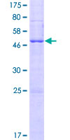 TMEM26 Protein - 12.5% SDS-PAGE of human TMEM26 stained with Coomassie Blue