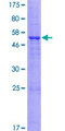 TMEM27 / Collectrin Protein - 12.5% SDS-PAGE of human TMEM27 stained with Coomassie Blue