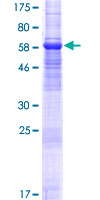 TMEM30A Protein - 12.5% SDS-PAGE of human TMEM30A stained with Coomassie Blue