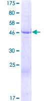TMEM33 Protein - 12.5% SDS-PAGE of human TMEM33 stained with Coomassie Blue