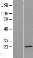 TMEM35 Protein - Western validation with an anti-DDK antibody * L: Control HEK293 lysate R: Over-expression lysate