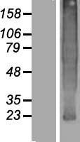 TMEM37 Protein - Western validation with an anti-DDK antibody * L: Control HEK293 lysate R: Over-expression lysate