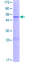 TMEM38A Protein - 12.5% SDS-PAGE of human TMEM38A stained with Coomassie Blue
