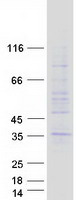 TMEM38A Protein - Purified recombinant protein TMEM38A was analyzed by SDS-PAGE gel and Coomassie Blue Staining