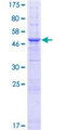 TMEM38B Protein - 12.5% SDS-PAGE of human TMEM38B stained with Coomassie Blue