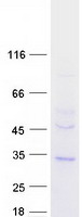 TMEM38B Protein - Purified recombinant protein TMEM38B was analyzed by SDS-PAGE gel and Coomassie Blue Staining