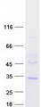 TMEM38B Protein - Purified recombinant protein TMEM38B was analyzed by SDS-PAGE gel and Coomassie Blue Staining