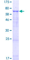 TMEM39A Protein - 12.5% SDS-PAGE of human TMEM39A stained with Coomassie Blue