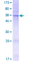 TMEM39B Protein - 12.5% SDS-PAGE of human TMEM39B stained with Coomassie Blue