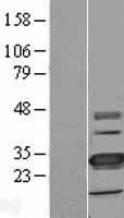 TMEM41A Protein - Western validation with an anti-DDK antibody * L: Control HEK293 lysate R: Over-expression lysate
