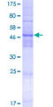 TMEM41A Protein - 12.5% SDS-PAGE of human TMEM41A stained with Coomassie Blue