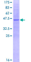 TMEM41B Protein - 12.5% SDS-PAGE of human TMEM41B stained with Coomassie Blue