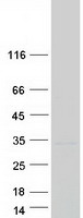 TMEM41B Protein - Purified recombinant protein TMEM41B was analyzed by SDS-PAGE gel and Coomassie Blue Staining