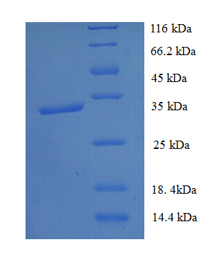 TMEM44 Protein
