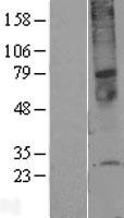 TMEM45A Protein - Western validation with an anti-DDK antibody * L: Control HEK293 lysate R: Over-expression lysate