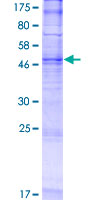 TMEM45B Protein - 12.5% SDS-PAGE of human TMEM45B stained with Coomassie Blue